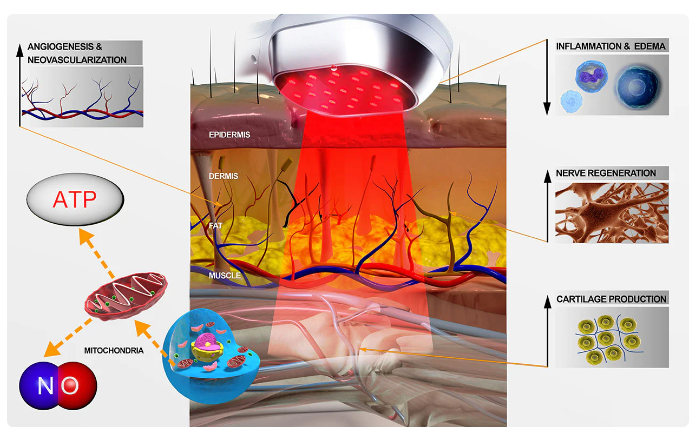 Axentoo Cold Laser Device