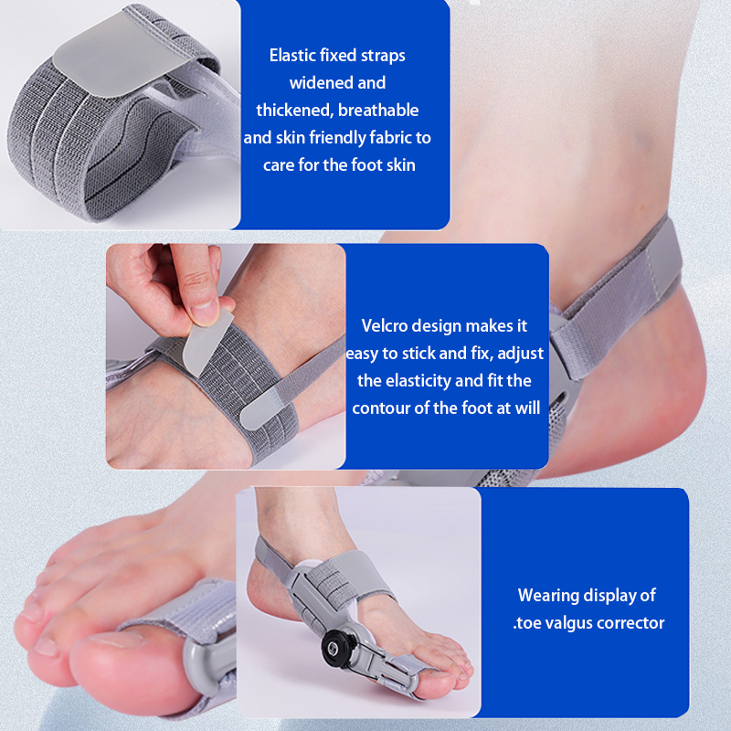 Bunion Fix