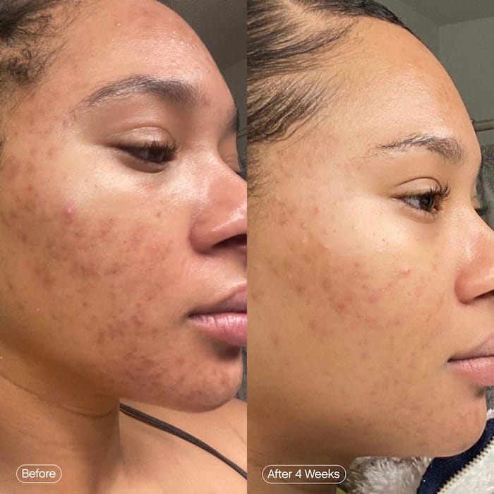 Turmeric Touch Cleanser - [30 Day Glow up]