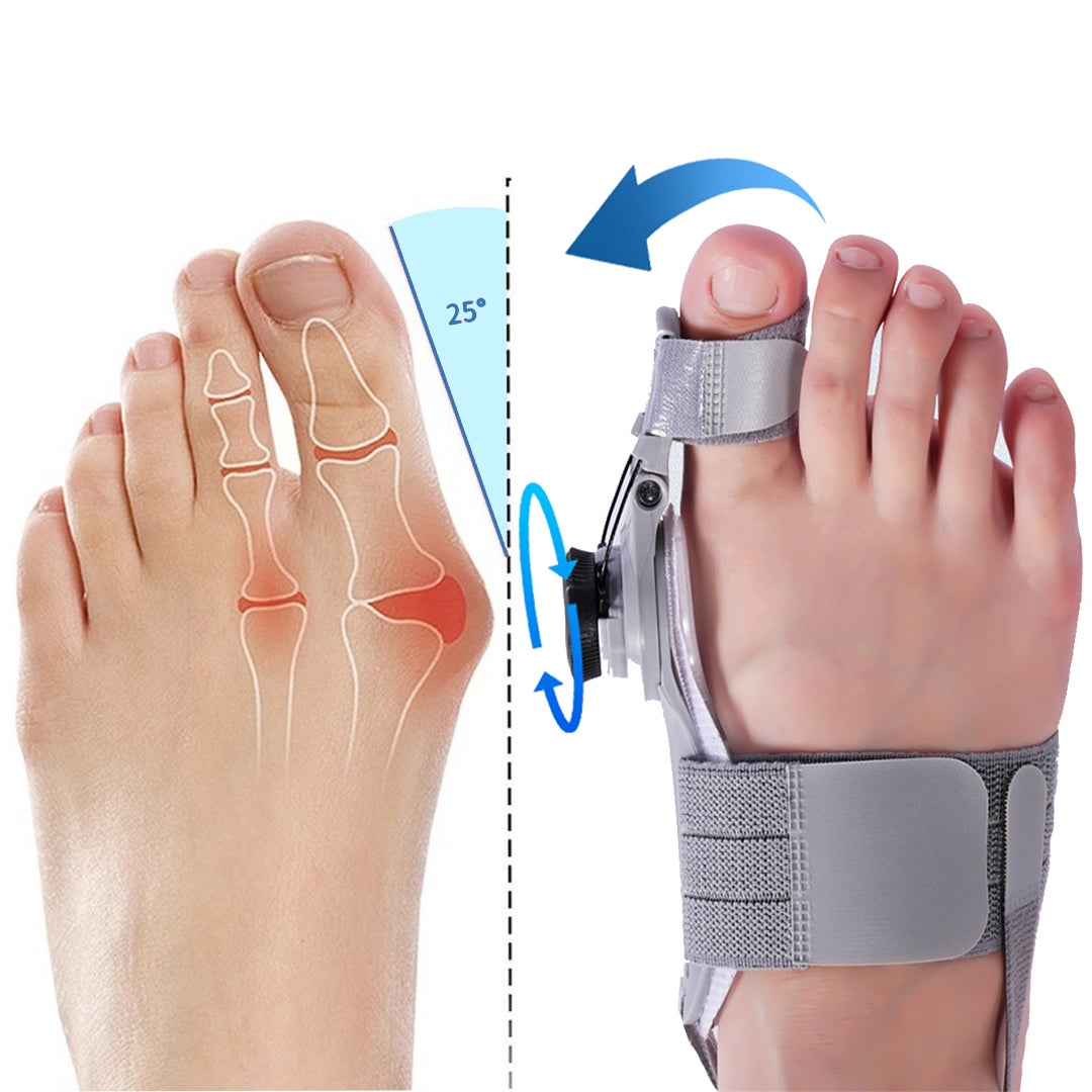 Bunion Fix